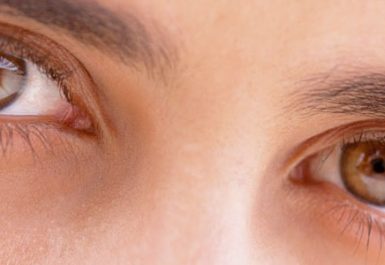 Blefaroplastia