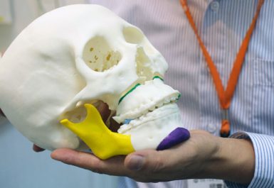Reconstrucción de cabeza con impresiones 3D